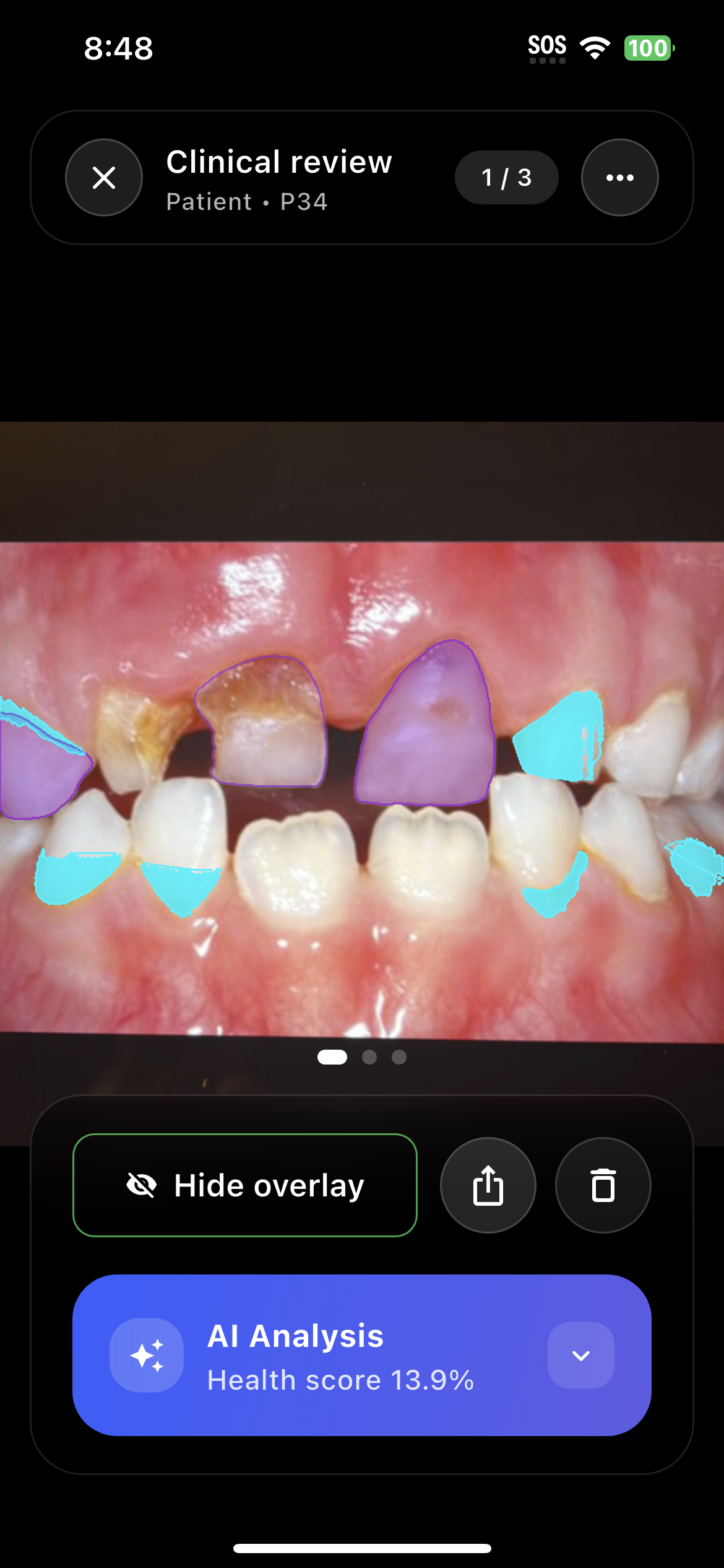AI Analysis Interface
